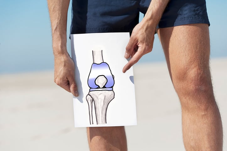 man holding an image of the knee bone right in front of his knee